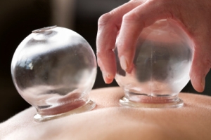 cupping.jpg